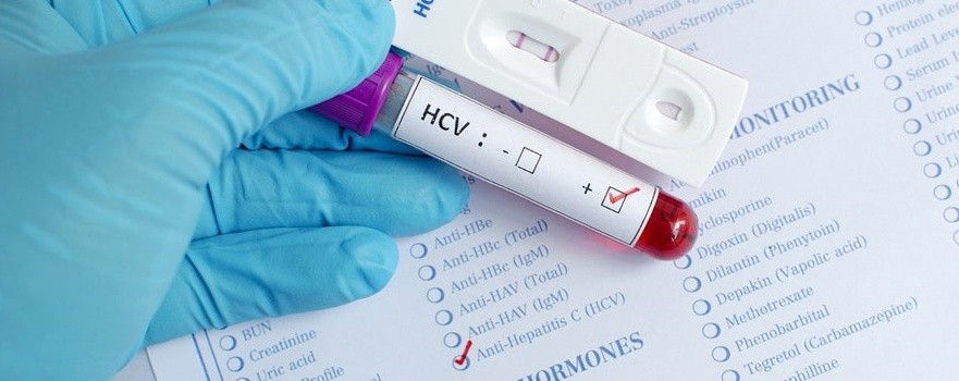 Зачем проходить тест на anti-HCV- фото № 1 Зачем проходить тест на anti-HCV